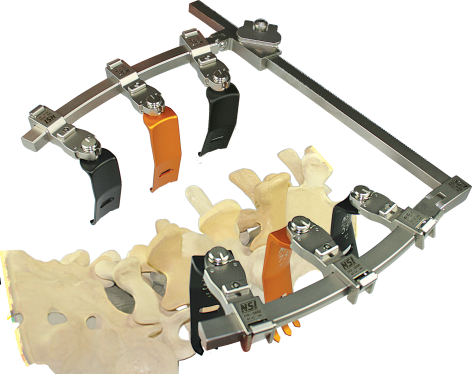 Clear-Line LS retractor engaged on a lumbar spine model (NSI)
