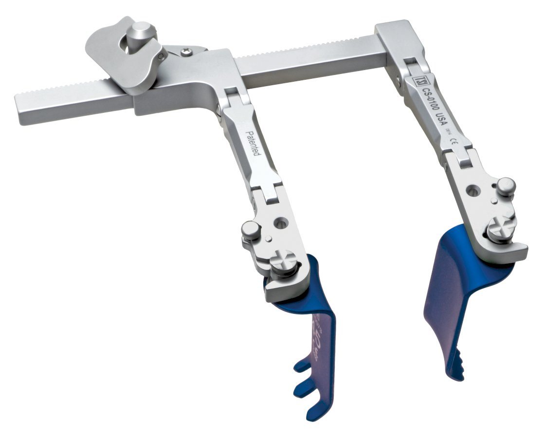 Phantom CS retractor with blades engaged (vendor photo — TeDan Surgical)
